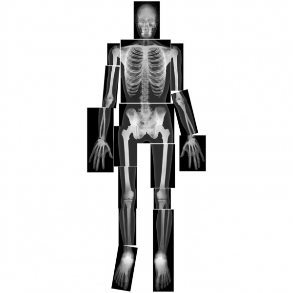 (주)생물나라,사람 X-Ray 사진세트