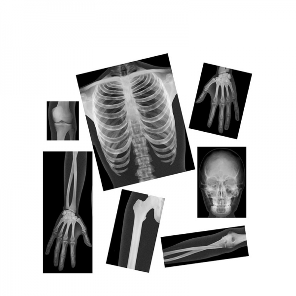 (주)생물나라,사람 X-Ray 사진세트